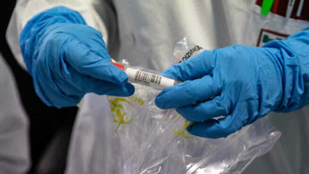Covid-19: al via il 2° screening all’Unisa, nuovi contagi ad Eboli e Battipaglia